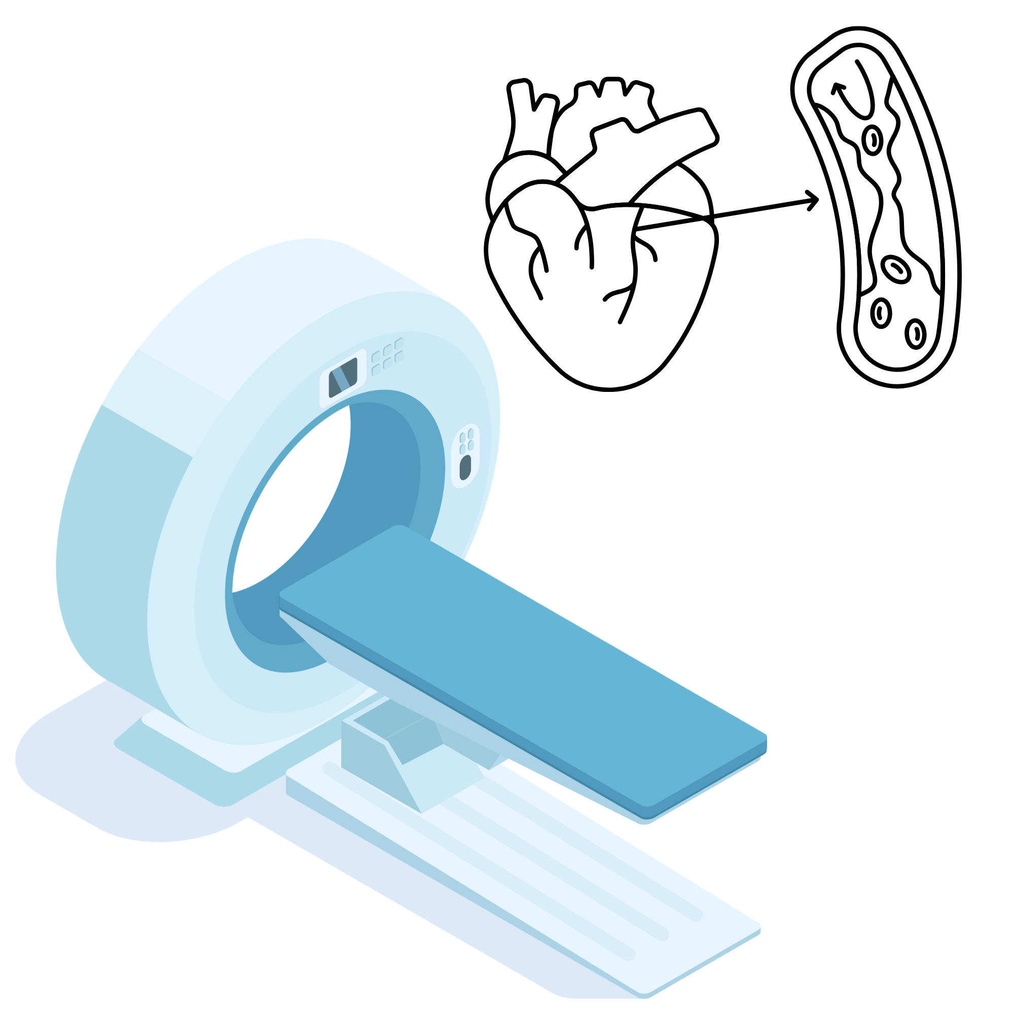 CT Add-on – Coronary Artery Calcification (Heart)